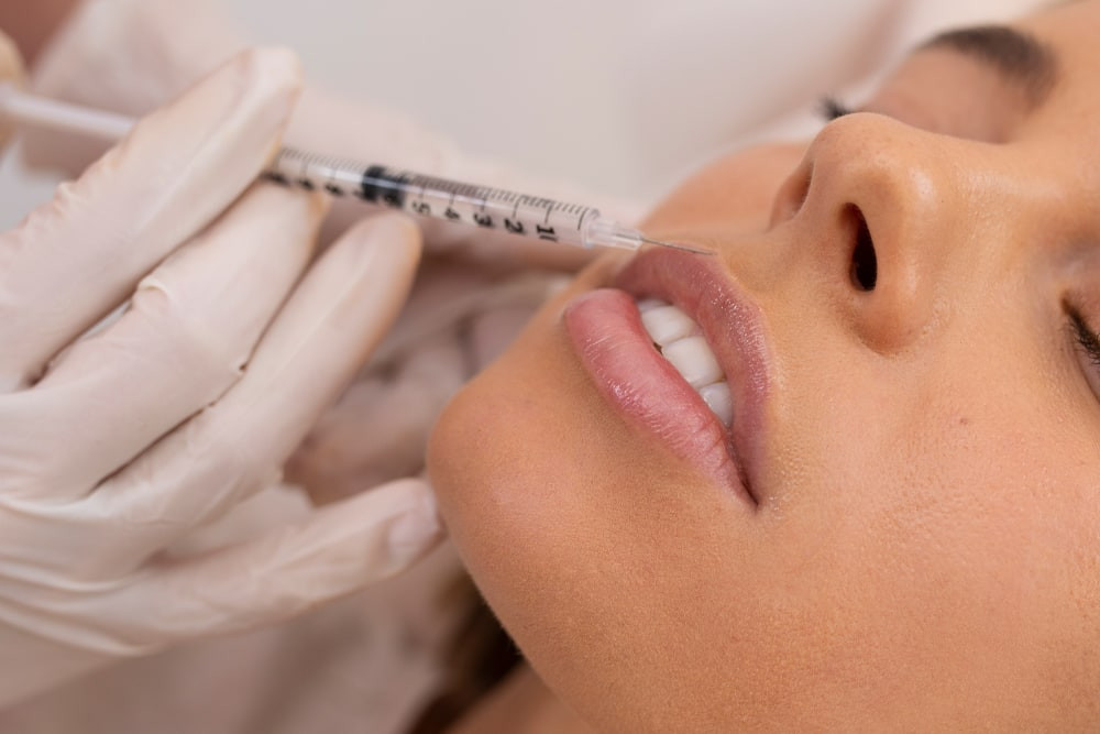 Lippenvergrößerung Dortmund - Frau werden Lippen unterspritzt Lippenvergrößerung Dortmund - Frau werden Lippen unterspritzt